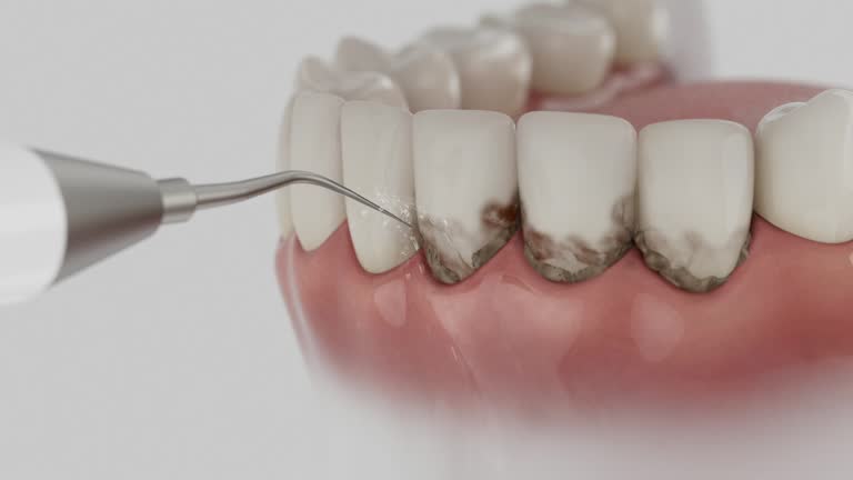 Trusted Invisalign Clear Aligners service in Seaville, NJ - Dentist Open Now